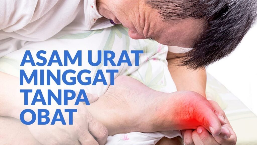 Obat Penyembuhan Asam Urat