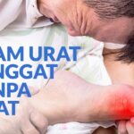 Obat Penyembuhan Asam Urat